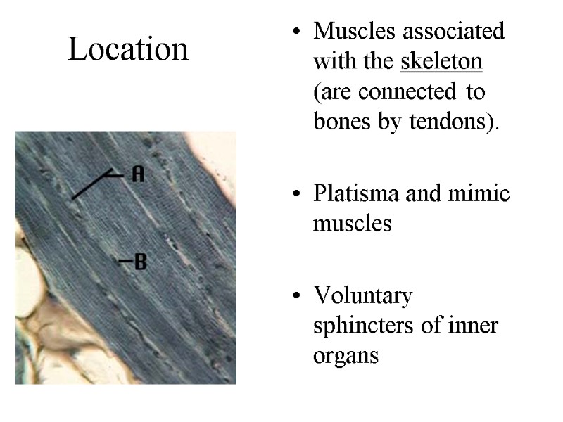 Location Muscles associated with the skeleton (are connected to bones by tendons).  